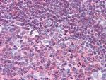 PYK2 Antibody in Immunohistochemistry (Paraffin) (IHC (P))