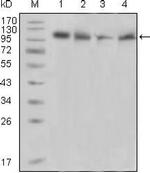 PYK2 Antibody in Western Blot (WB)