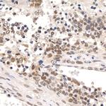 Paf1 Antibody in Immunohistochemistry (IHC)