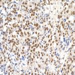 Paf1 Antibody in Immunohistochemistry (IHC)