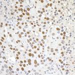 Paf1 Antibody in Immunohistochemistry (IHC)