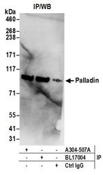 Palladin Antibody in Western Blot (WB)