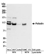 Palladin Antibody in Western Blot (WB)