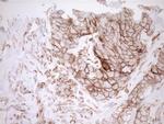 Pan-CDH Antibody in Immunohistochemistry (Paraffin) (IHC (P))