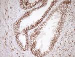 Pan-CDH Antibody in Immunohistochemistry (Paraffin) (IHC (P))