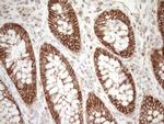 Pan-CDH Antibody in Immunohistochemistry (Paraffin) (IHC (P))