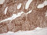 Pan-CDH Antibody in Immunohistochemistry (Paraffin) (IHC (P))