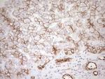 Pan-CDH Antibody in Immunohistochemistry (Paraffin) (IHC (P))