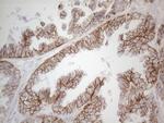 Pan-CDH Antibody in Immunohistochemistry (Paraffin) (IHC (P))