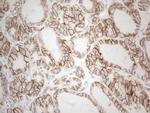 Pan-CDH Antibody in Immunohistochemistry (Paraffin) (IHC (P))