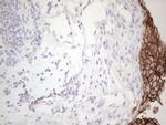 Pan-CDH Antibody in Immunohistochemistry (Paraffin) (IHC (P))