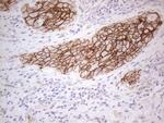 Pan-CDH Antibody in Immunohistochemistry (Paraffin) (IHC (P))