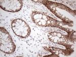 Pan-CDH Antibody in Immunohistochemistry (Paraffin) (IHC (P))