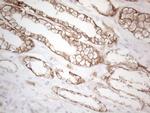 Pan-CDH Antibody in Immunohistochemistry (Paraffin) (IHC (P))