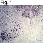 Parkin Antibody in Immunohistochemistry (IHC)