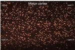 Parvalbumin Antibody in Immunohistochemistry (IHC)