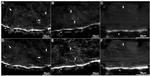 Parvalbumin Antibody in Immunohistochemistry (IHC)