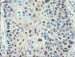 Patched1 Antibody in Immunohistochemistry (Paraffin) (IHC (P))