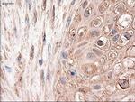 Patched1 Antibody in Immunohistochemistry (Paraffin) (IHC (P))