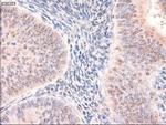 Patched1 Antibody in Immunohistochemistry (Paraffin) (IHC (P))