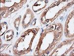 Patched1 Antibody in Immunohistochemistry (Paraffin) (IHC (P))