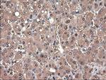 Patched1 Antibody in Immunohistochemistry (Paraffin) (IHC (P))