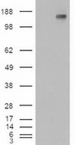 Patched1 Antibody in Western Blot (WB)