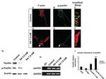 Paxillin Antibody in Western Blot (WB)