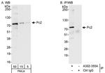 Pc2 Antibody in Western Blot (WB)