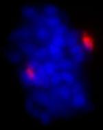 Pericentrin/Kendrin Antibody in Immunocytochemistry (ICC/IF)