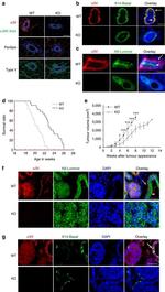 Perilipin A/B Antibody in Immunohistochemistry (Paraffin) (IHC (P))