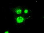 Periostin Antibody in Immunocytochemistry (ICC/IF)