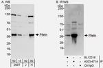 Pfetin Antibody in Western Blot (WB)