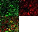 Phalloidin Control in Immunocytochemistry (ICC/IF)