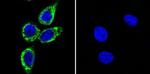 Phospho-CaMKII alpha (Thr286) Antibody in Immunocytochemistry (ICC/IF)