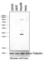 Phospho-GYS1 (Ser641, Ser645) Antibody in Western Blot (WB)