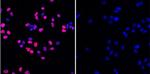 Phospho-Histone H2A.X (Ser139) Antibody in Immunocytochemistry (ICC/IF)