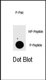 Phospho-TAB1 (Ser423) Antibody in Dot Blot (DB)