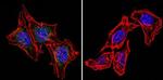 Phospho-Progesterone Receptor (Ser294) Antibody in Immunocytochemistry (ICC/IF)