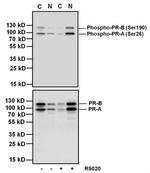 Phospho-Progesterone Receptor (Ser190) Antibody in Western Blot (WB)