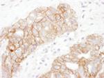 Plakoglobin Antibody in Immunohistochemistry (IHC)