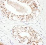 Plakoglobin Antibody in Immunohistochemistry (IHC)