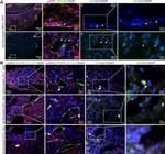 Podoplanin Antibody in Immunocytochemistry (ICC/IF)