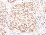 PolD1 Antibody in Immunohistochemistry (IHC)