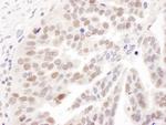 PolD1 Antibody in Immunohistochemistry (IHC)