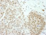 PolE3/p17 Antibody in Immunohistochemistry (IHC)