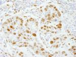 PolE3/p17 Antibody in Immunohistochemistry (IHC)