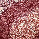 PARP1 Antibody in Immunohistochemistry (Paraffin) (IHC (P))