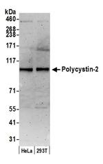 Polycystin-2 Antibody in Western Blot (WB)