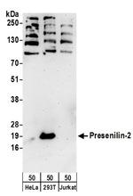 Presenilin-2 Antibody in Western Blot (WB)